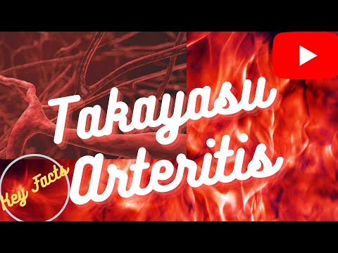 TAKAYASU Arteritis|What are the symptoms of Takayasu disease?(Pulseless disease)|usmle,neet pg,plab