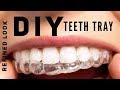 Homemade Teeth Whitening Paste | DIY Teeth Tray and Whitening Paste!