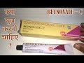 How to use Betnovate C skin cream | Reviews, Uses, Benefits & Side effects | Hindi