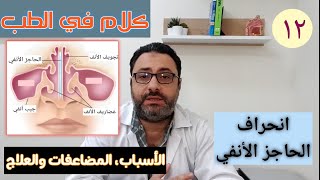 انحراف الحاجز الأنفي