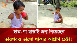 অবুঝ শিশুটির ভালো থাকার আপ্রাণ চেষ্টা ! Nagorik TV Special