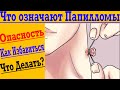 Настоящая причина Папиллом на теле ! Это ВАЖНО Знать !