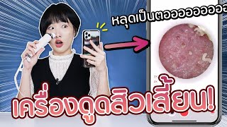 ซอฟรีวิว: เครื่องดูดสิวเสี้ยน ติดกล้องซูมพร้อมไฟ!【Xiaomi Good Time】 screenshot 5