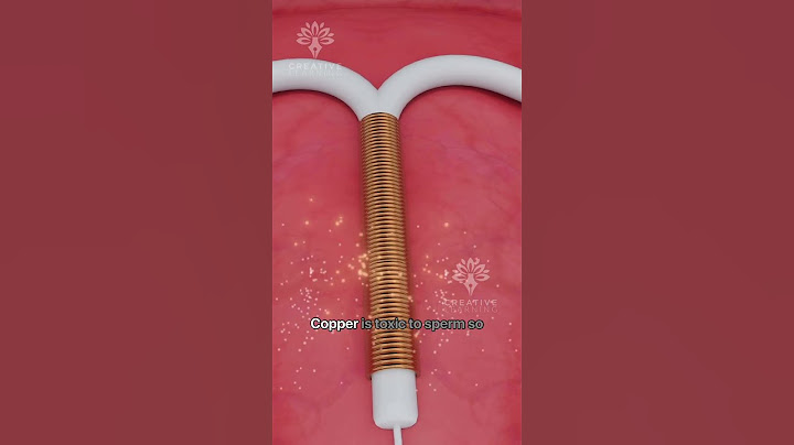 What Happens Inside Your Body After Copper T - Intrauterine Device (IUD) #shorts #pregnancy