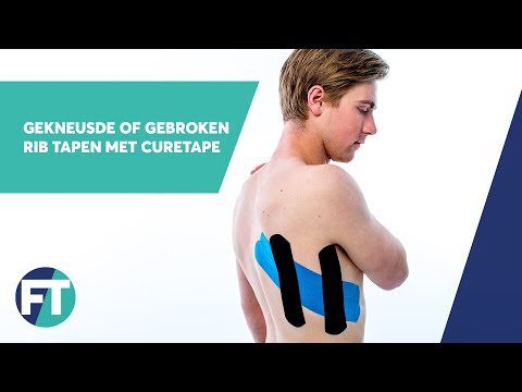 Hoe tape je een gekneusde of gebroken rib  | Medical Taping | FysioTape