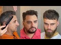 03 Cortes de cabelo masculino lindos e fáceis - PASSO A PASSO