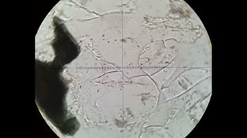Nepheline tutorial Optical mineralogy