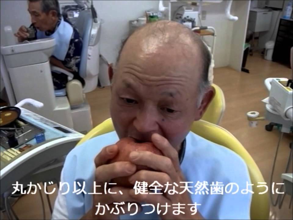 今井式すっぽんデンチャー改訂版、保険総義歯でリンゴ丸かじり！ - YouTube