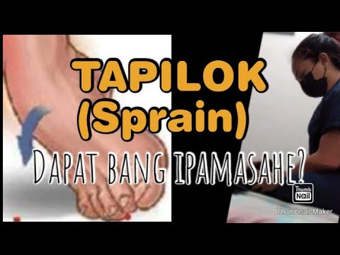 TAPILOK | ANKLE SPRAIN FIRST AID,dapat bang ipahilot? Tara pag-usapan natin