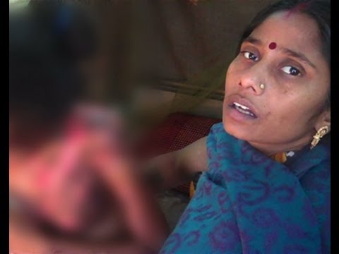 Rise to Support Acid Attack Survivor, Chanchal