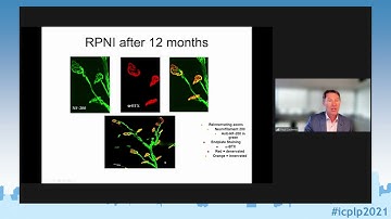 ICPLP2021 - Prof. Cederna: Use of RPNIs for the Prevention and Treatment of Neuroma and Phantom Pain