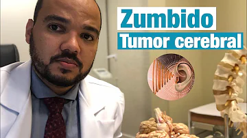 ¿Puede el tinnitus ser un tumor cerebral?