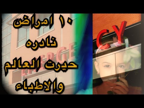 ١٠ امراض نادرة وغربية حيرت الاطباء والعالم