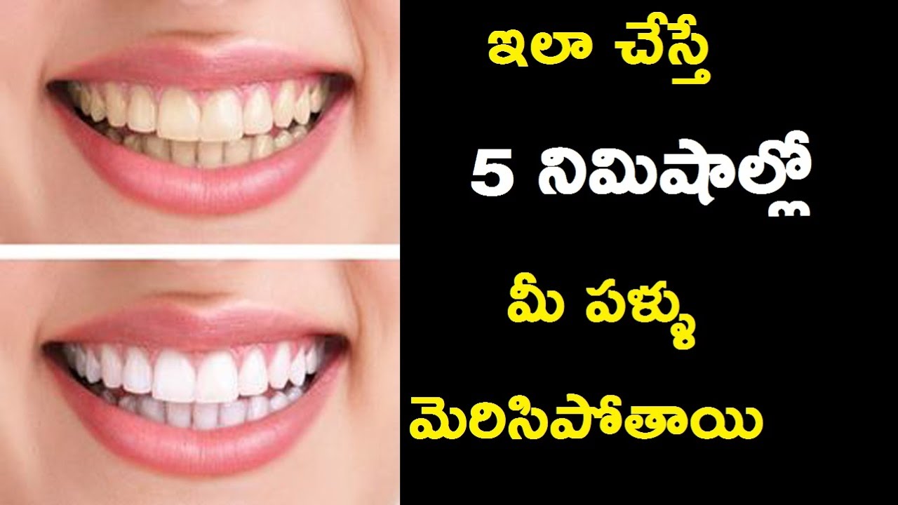 Tooth whitening at home in 5 minutes using baking soda Ttube Telugu