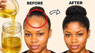 Just 1 INGREDIENT 😱 Apply it on your Hair for just 2 DAYS and your Hair will grow 3 Times FASTER!
