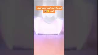 جهاز إزالة الشعر