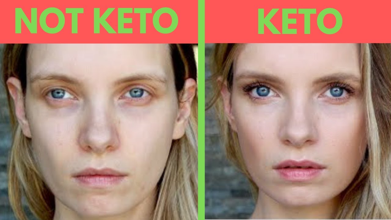 Why Keto is a Good Diet - YouTube