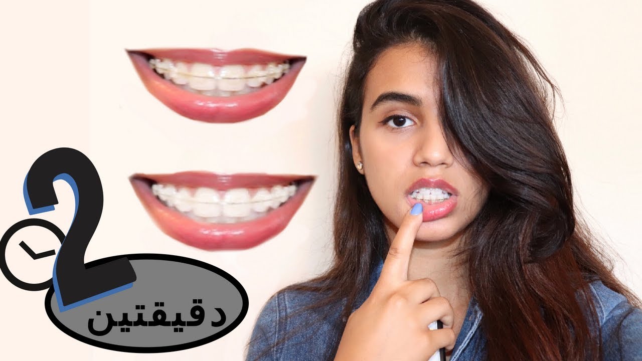 تبييض الأسنان في دقيقتين فقط!! (بياض مضمون) + ? Giveaway