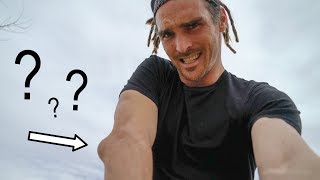 What is wrong with my elbow?