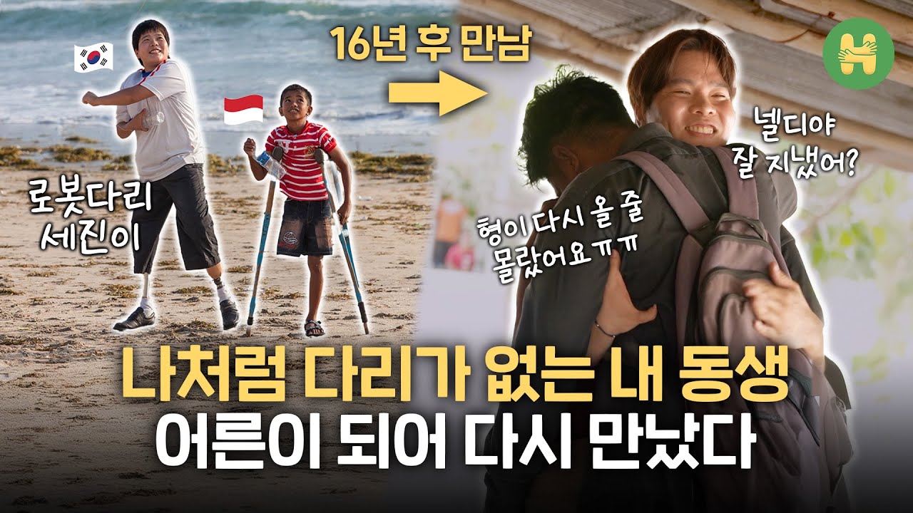 16년 전 내 '로봇다리'를 물려받은 동생의 대학 졸업식 | 어른이 된 '로봇다리 세진이' 근황