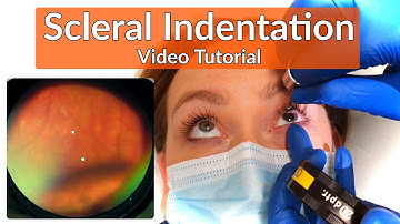 Scleral Indentation / Depression Tutorial