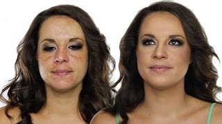 How To Cover Hyperpigmentation / Skin Pigmentation Using MakeUp | Shonagh Scott | ShowMe MakeUp