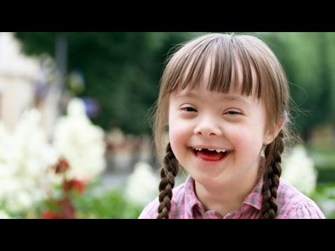 تناذر داون (متلازمة داون) للسنة الرابعة متوسط