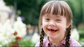 تناذر داون (متلازمة داون) للسنة الرابعة متوسط