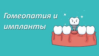 Гомеопатия и импланты