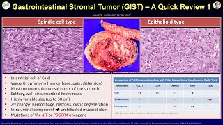 Patho Minutes Gastrointestinal Stromal Tumor Gist - A Quick Review Part 1