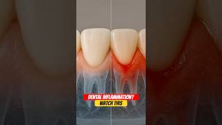 Bleeding When You Brush? Heres The Real Reason And How To Fix It