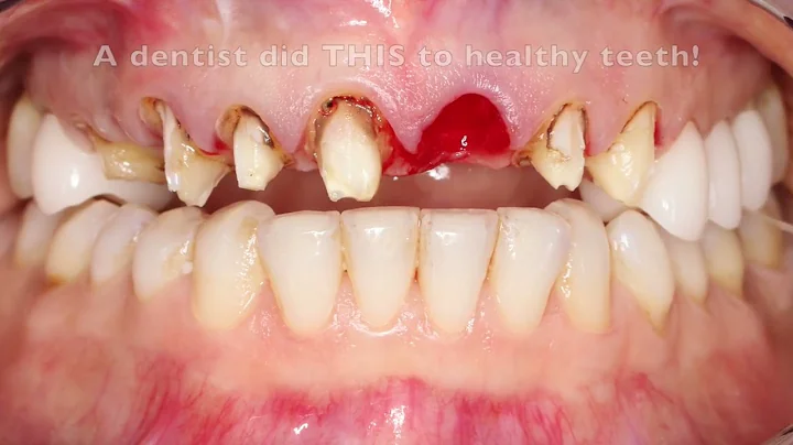 Toxic Tuesday:  To save your teeth and health, REA...