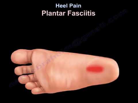 How Physical Therapy Can Help Your Plantar Fasciitis | Orthopaedic  Specialists located in Bloomfield Hills and Clarkston, MI | Orthopedic  Specialists of Oakland County