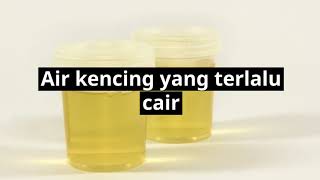 Garisan Ujian Kehamilan Yang Kabur (Urine Pregnancy Test)