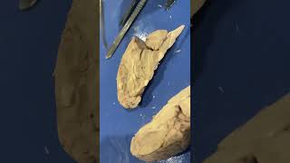 Brain Dissection Practical BIO 220L A&P I Lab