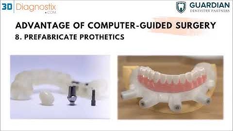 Introduction to Surgical Guides and Implant Case Planning