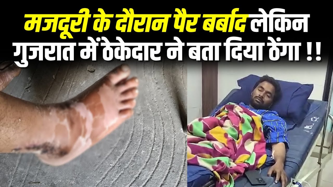 मजदूरी के दौरान पैर बर्बाद लेकिन गुजरात में ठेकेदार ने बता दिया ठेंगा !! #cblive