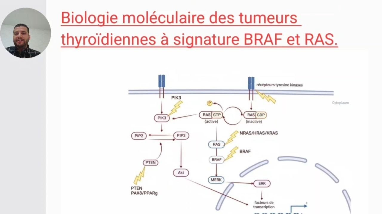 Biologie moléculaire des tumeurs thyroïdiennes à signature BRAF et RAS