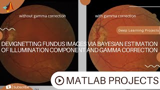 Devignetting Fundus Images Via Bayesian Estimation Of Illumination Component And Gamma Correction