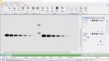 Selecting Local Background Subtraction Method | Data Analysis and Basic Quantification