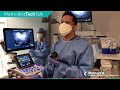 Tech talk endoscopic ultra sound eus