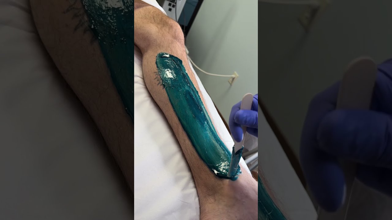 Professional Lower Leg Wax Using Blue Hard Formula From Starpil Esthetician Waxing