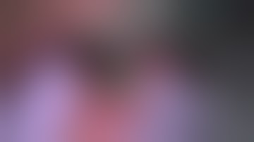 Physics Forceps Extraction of Decayed Roots on Lower Mouth from GoldenDent, Atraumatic Extraction