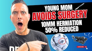 How to AVOID spinal surgery? SEE THIS!
