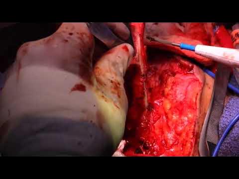 Togri chuqur tomoq oral seks amaliyotini tomosha qiling