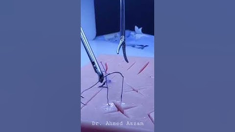 Laparoscopic suturing - surgical knot