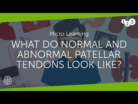 What do normal and abnormal patellar tendons look like?