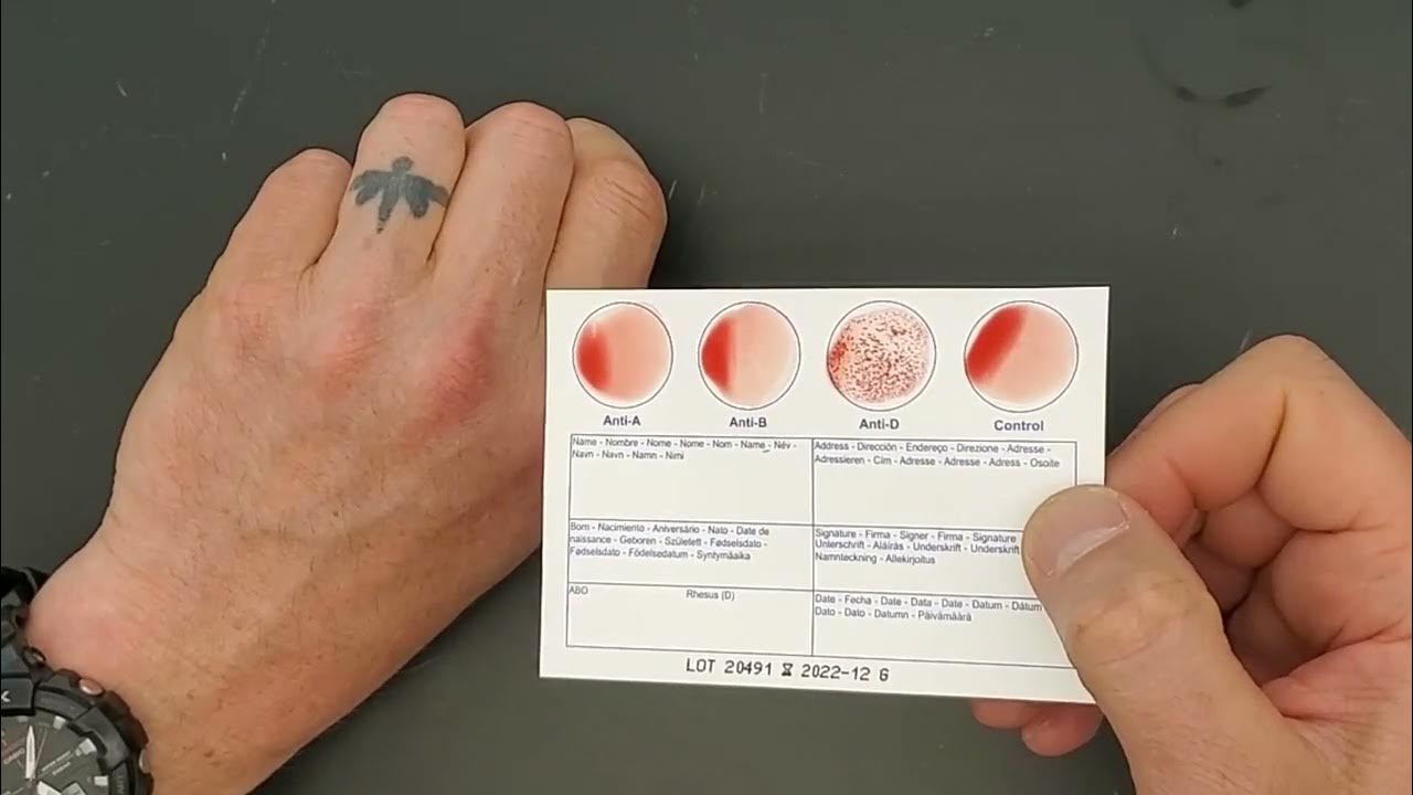 ELDONCARD BLOOD TYPE TEST COMPLETE KIT A,B,O,AB & RHESUS D 