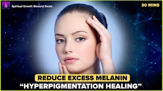 ⭐HYPERPIGMENTATION HEALING BINAURAL BEATS⭐Remove Excess Melanin | Skin Lightening | Glutathione by Spiritual Growth - Binaural Beats Meditation 1,093 views 7 months ago 37 minutes