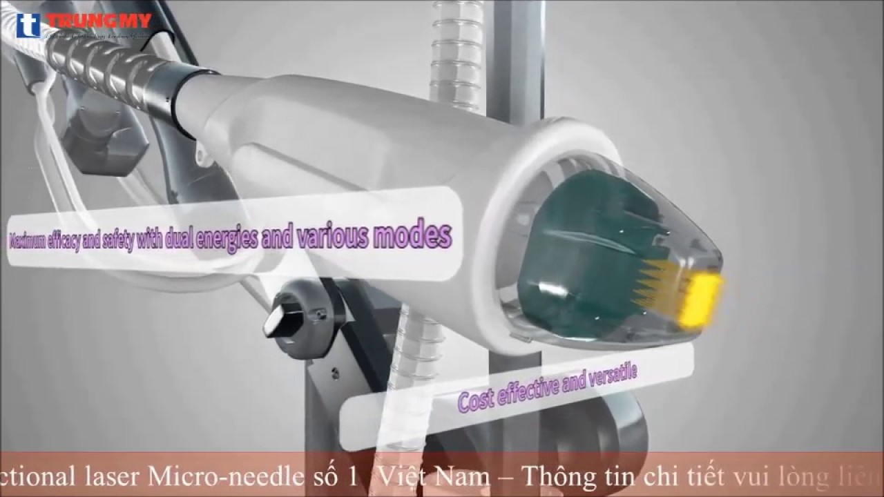 Fraxis DUO kết hợp giữa laser Fractional Co2 và công nghệ vi kim Fractional RF